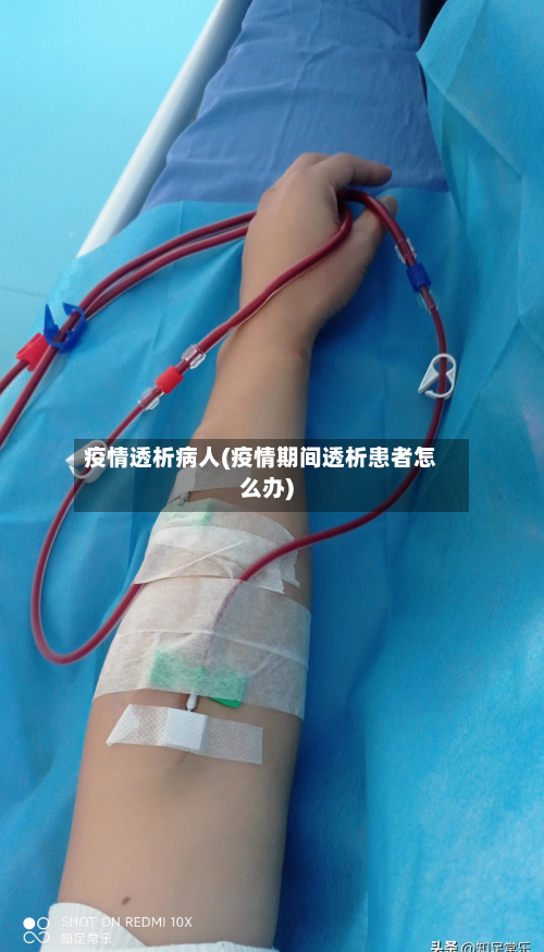疫情透析病人(疫情期间透析患者怎么办)-第3张图片