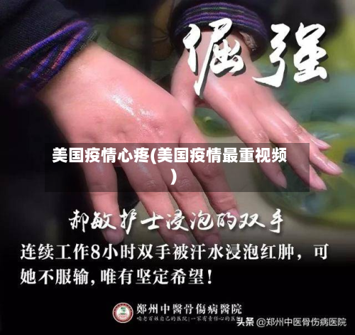 美国疫情心疼(美国疫情最重视频)-第1张图片