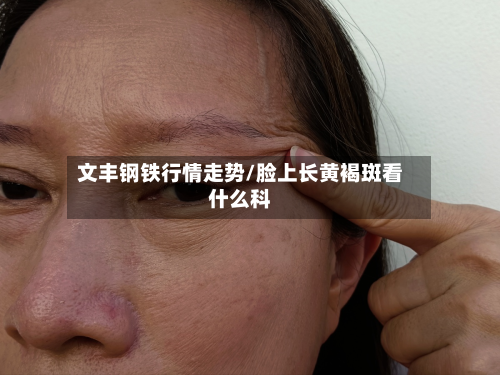 文丰钢铁行情走势/脸上长黄褐斑看什么科-第1张图片